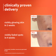 Plum Goodness 1% Vitamin C Ultra-Light-Glow Boosting Gel Cream For Glowing Skin