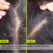 Plix Neem Anti-Dandruff Advanced Shampoo (For Reduced Dandruff & Itchiness) – 100ml
