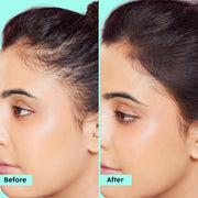 Plix Rosemary Anti-Hairfall Advanced Kit with Oil, Shampoo, Conditioner & Serum – 30ml + 200ml + 175ml + 100ml