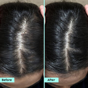 Plix Rosemary Anti-Hairfall Advanced Kit with Oil, Shampoo, Conditioner & Serum – 30ml + 200ml + 175ml + 100ml