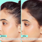 Plix Rosemary Hair Growth Advanced Spray for Fuller, Thicker Hair – 100ml