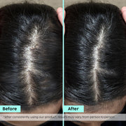 Plix Rosemary Hair Growth Advanced Spray for Fuller, Thicker Hair – 100ml