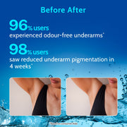 Chemist At Play Neck Knee Roll On - 40 ml & Underarm Roll On Aqua - 40 ml