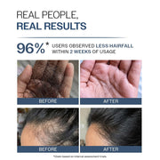 Bare Anatomy Anti-Hair Fall Shampoo | Provides 5x Hair Fall Control | pH 4.6 | Adenosine & Peptides | Strengthens Weak Roots & Reduces Breakage | Sulphate & Paraben Free | Unisex |
