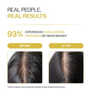 Bare Anatomy Oil Control Shampoo | Sulphate & Paraben Free | Reduces Excess Oil by Up to 100% | Salicylic Acid + Hyaluronic Acid + Tea Tree | Suitable for Oily Scalp & Dry Ends | For Women & Men |