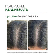 Bare Anatomy Anti-Dandruff Shampoo | Up To 100% Dandruff Reduction | ZPTO-Free | pH 5.3 | Salicylic Acid, Piroctone Olamine, Biotin & Menthol | Non-Drying Formula | Suitable for Men & Women |