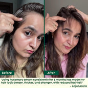 Plix Rosemary Hair Growth Serum | 3% Redensyl for Faster Hair Regrowth – 30 ml
