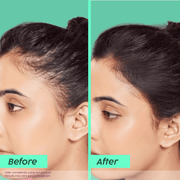 Plix Rosemary Anti-Hair Fall Advanced Shampoo (For Stronger, Fuller Hair ) – 100ml