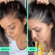Plix Rosemary Anti-Hair Fall Advanced Shampoo (For Stronger, Fuller Hair ) – 100ml