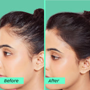 Plix Rosemary Anti-Hairfall Advanced Kit – Shampoo, Conditioner & Serum with 3% Redensyl