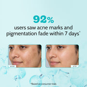 Chemist At Play 10% Niacinamide Clarifying Face Serum for Hyperpigmentation & Dark Spots -10 ml