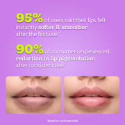 Chemist At Play Lip Jelly Kiss Collection - 10 gm | Pack of 4