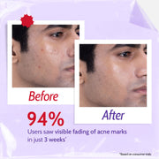 Chemist At Play 2% Salicylic Acid Face Wash for Acne & Oil Control - 100 ml