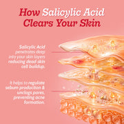 Chemist At Play 2% Salicylic Acid Face Serum With Lactic Acid For Acne Control - 30 ml