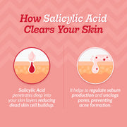 Chemist At Play 2% Salicylic Acid Face Serum With Lactic Acid For Acne Control - 10 ml
