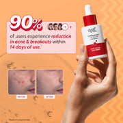 Chemist At Play 2% Salicylic Acid Face Serum With Lactic Acid For Acne Control - 30 ml