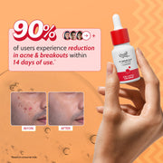 Chemist At Play 2% Salicylic Acid Face Serum With Lactic Acid For Acne Control - 10 ml