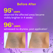 Chemist At Play Neck, Knee & Elbow Brightening Roll On With Mandelic Acid & Niacinamide - 40 ml