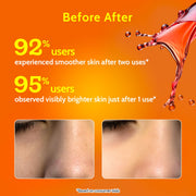 Chemist At Play 26% AHA + 4% PHA + 2% BHA Exfoliating Peeling Solution for Tan Removal & Pigmentation - 30 ml